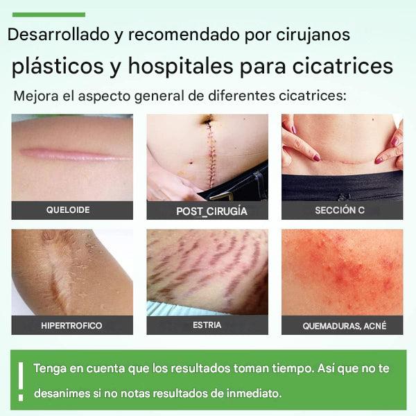 ¡Láminas de Silicona - Piel Radiante, Cicatrices Olvidadas💥